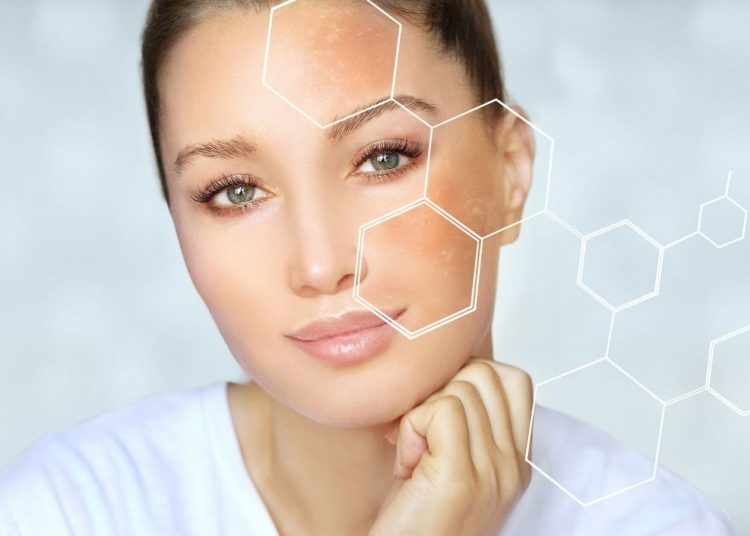 EuropaPress_3917976_verano_momento_luchar_contra_manchas_solares-750x536